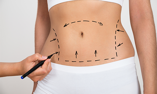 Comment se débarrasser de la graisse abdominale chez la femme ?